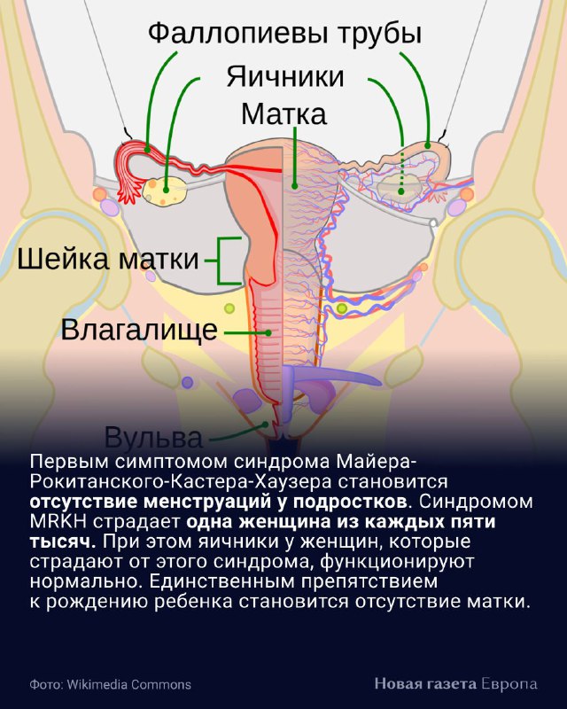 Стоимость Пересадки Матки